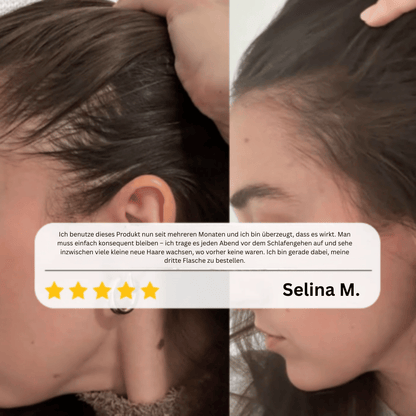 Haarwachstums Roll-on-Serum